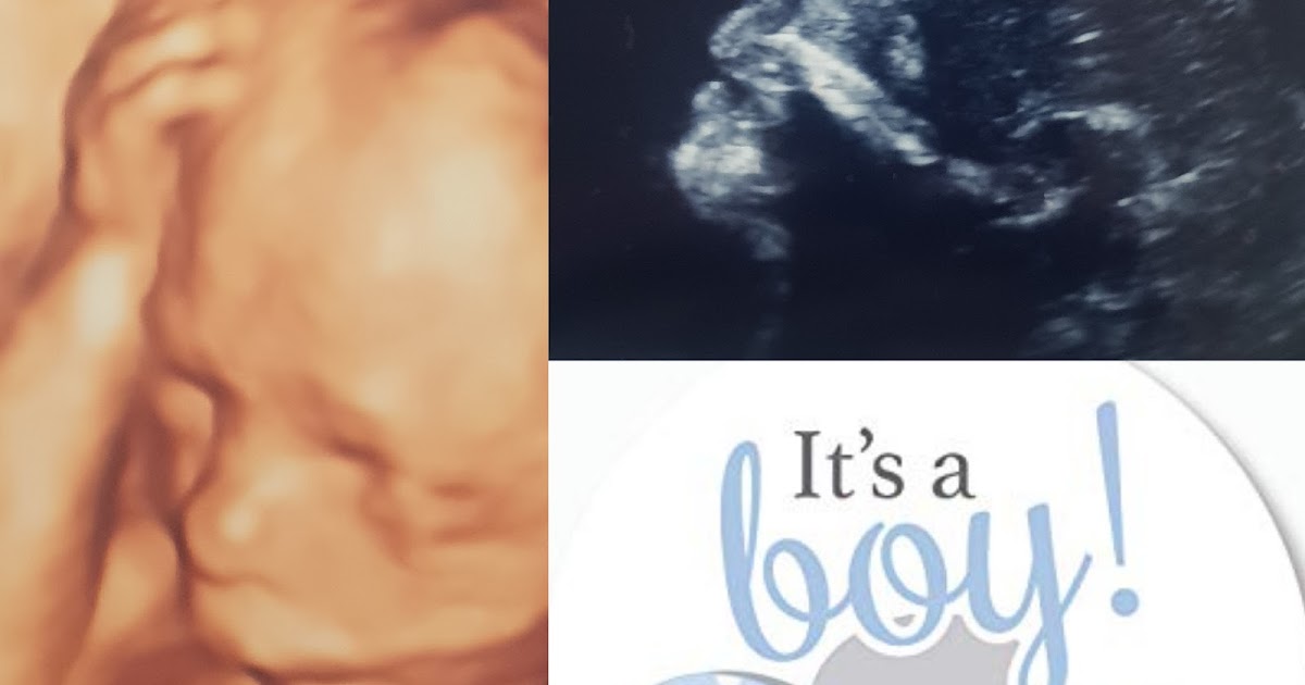 Its a boy!