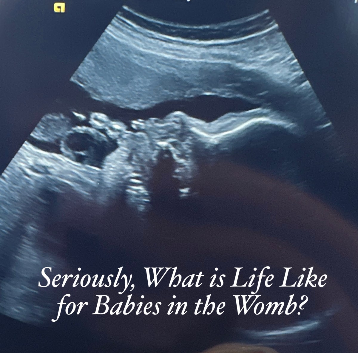 Seriously, What is Life Like for Babies in the Womb? – BeautyBeyondBones